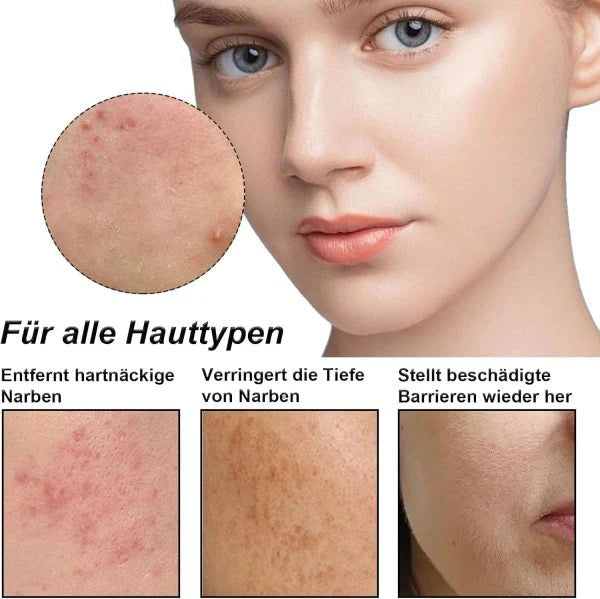 THE HEALTH HEALER Night Cream jar front view

Texture of night cream on hand

Before and after skin results using THE HEALTH HEALER Night Cream

Night skincare routine with HEALTH HEALER Night Cream